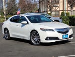 2016 Acura TLX V6 Advance