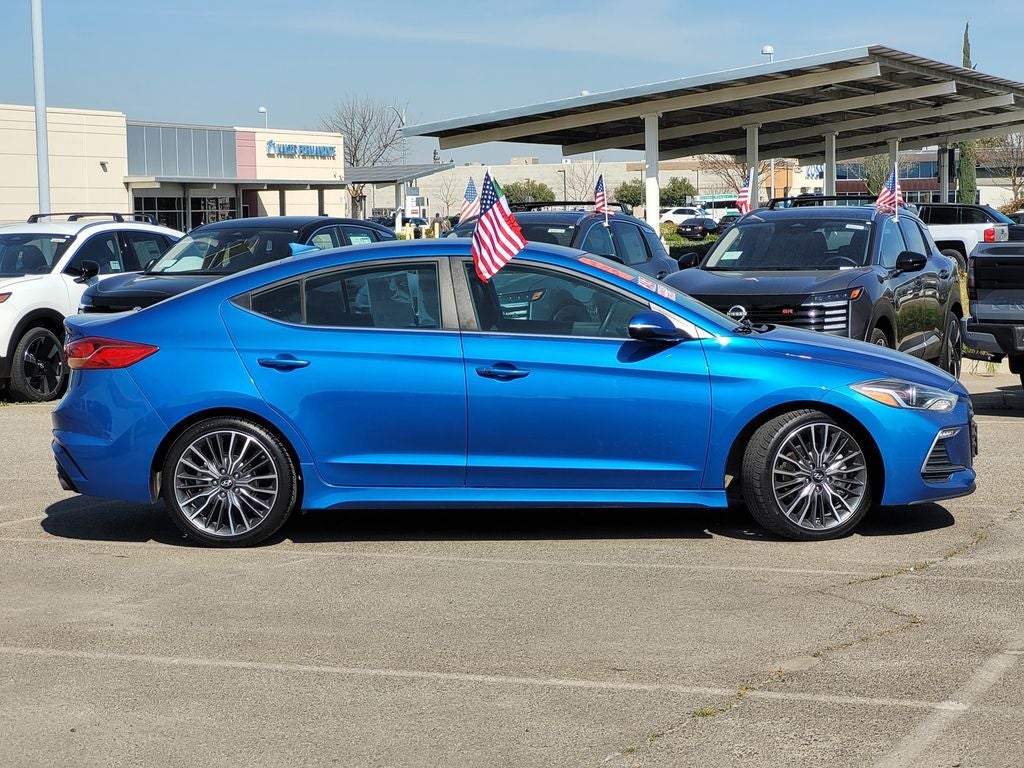 2017 Hyundai Elantra Sport