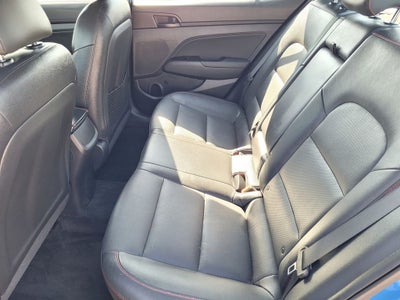 2017 Hyundai Elantra Sport